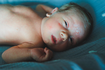 The baby is sleeping. A newborn baby is sleeping. Baby with dry skin