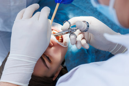The dentist examines the patient's teeth using dental equipment. Modern medical equipment. Anesthesia of the teeth with local anesthesia. The concept of oral treatment. Close-up. Selective focus.の写真素材