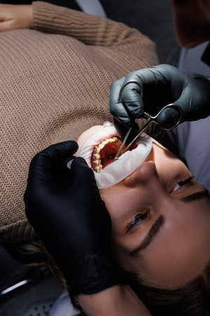 Close-up of teeth with metal braces. Orthodontic treatment of the jaw