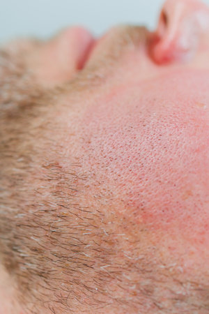 A cosmetologist cleans the skin of a man's face. A man does facial procedures in a cosmetic clinic. Male cosmetology.の写真素材