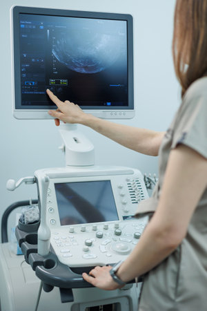 Ultrasound machine for body examination. Modern apparatus in the doctor's office.の写真素材