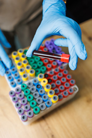 Test tubes with blood. Taking blood from a vein for research