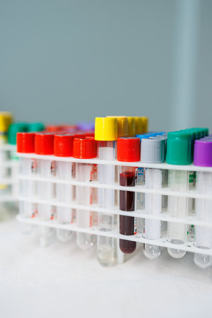 Test tubes with blood. Taking blood from a vein for research