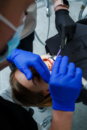 The orthodontist puts metal braces on the patient's teeth. Orthodontic dental treatment. High quality photoの写真素材