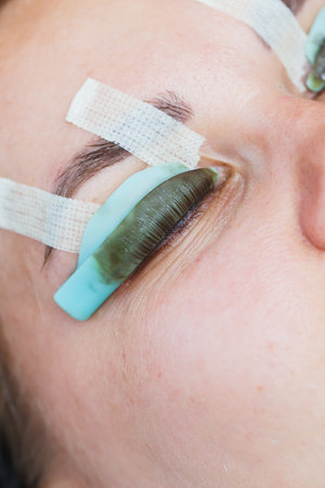 An indepth look at an individual receiving eyelash extensions, focusing on the use of protective pads over the eyes for safety and comfort throughout the procedureの写真素材
