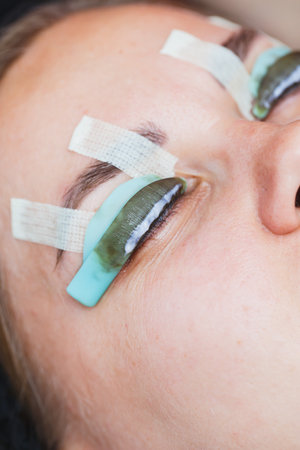A closeup view of an intricate beauty treatment focusing on eyelash extensions, highlighting the protective pads and tape used for safety and precision during applicationの写真素材