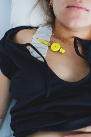 This image shows a closeup of a patient in a hospital bed with an IV catheter and monitoring device, emphasizing key aspects of their medical care and ongoing treatmentの写真素材