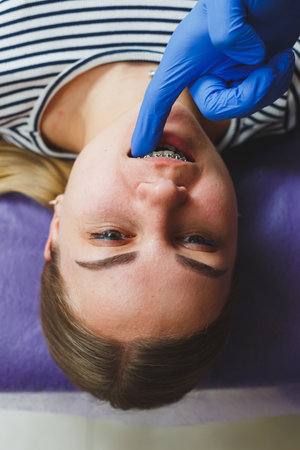 A young woman relaxes in a dental chair while a skilled professional fits braces onto her teeth. The bright, friendly clinic enhances her confidence as treatment begins.の写真素材