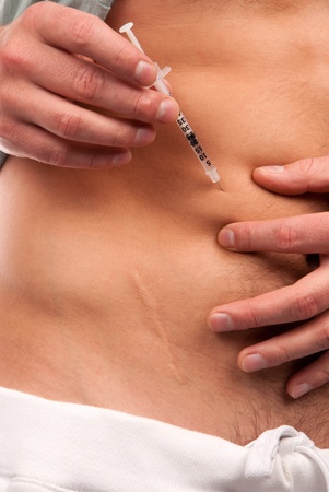 First type Diabetes patient giving himself abdomen insulin injection shot by single use syringe with dose of humalog isolated on a white backgroundの写真素材