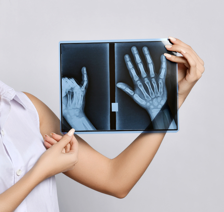 Doctor woman hands hold X-ray examination on gray