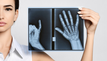 Doctor woman hold hands X-ray examination on gray background
