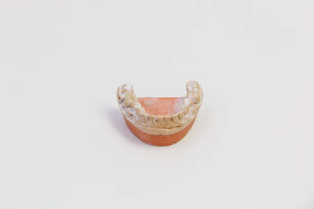 The cast of teeth isolated on white background. Denture, close up