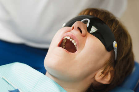 Close up process of preparing and installing dental ceramic crown. Male professional dentist helps...