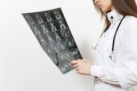 Close up doctor woman holds x-ray radiographic image ct scan mri isolated on white background....