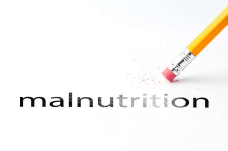Closeup of pencil eraser and black malnutrition text. Malnutrition. Pencil with eraser.の写真素材