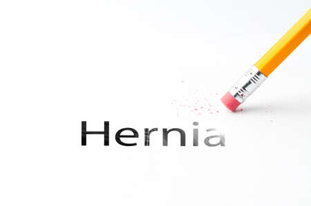 Closeup of pencil eraser and black hernia text. Hernia. Pencil with eraser.の写真素材