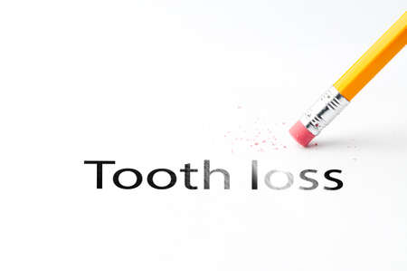 Closeup of pencil eraser and black tooth loss text. Tooth loss. Pencil with eraser.の写真素材