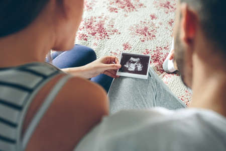 Couple looking at ultrasound of their baby sitting on the bed. Selective background focus on ultrasoundの写真素材