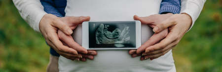 Man showing ultrasound of his son on the mobile over his wifes belly
