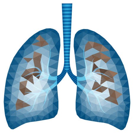 Abstract polygonal image of sick lungs - vector illustrationのイラスト素材