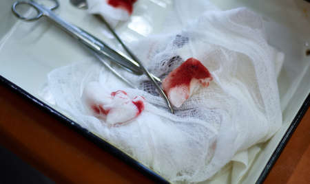 Top view of the white tray with pieces of bandage stained with blood.の写真素材