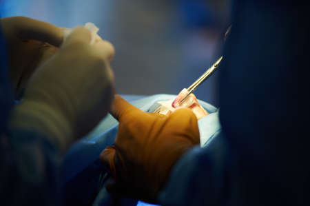 Surgery. Close-up of surgeon's hand with a clamp. Bleeding.