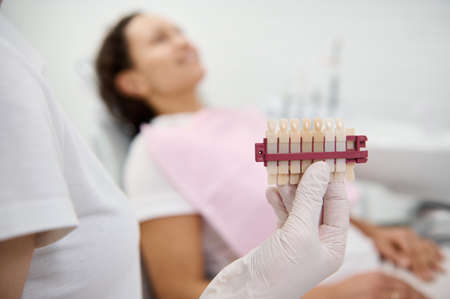 Dentist's hand in sterile surgical glove holding a tooth color chart for choosing patient's teeth whitening level. Procedure for comparing color shades of teeth with samples after bleaching. Close-up.の写真素材