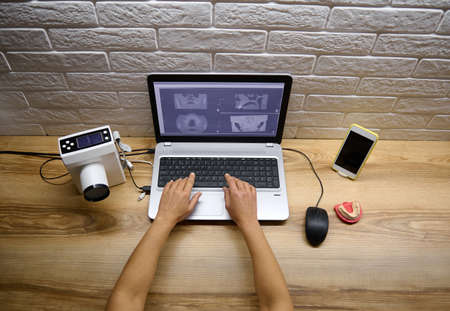 Overhead view of doctor radiologist dentist hands typing on keyboard of laptop with panoramic dental...