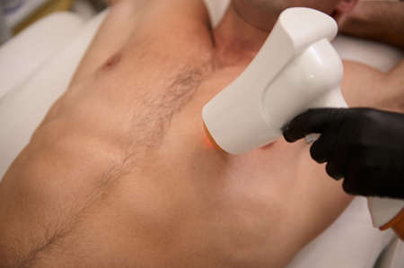 Top view of the torso of a man during a hair removal procedure in a laser epilation studio. Laser hair removal for men using a modern ultrasonic hair removal machine. Male waxing. Close-up.の写真素材