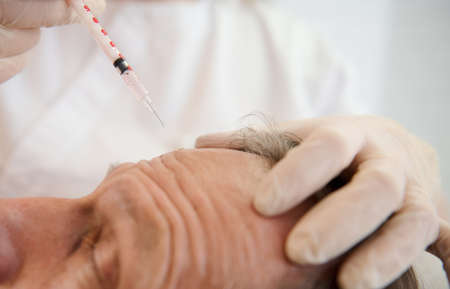 Close-up of a beautician holding a syringe and making facial injection to handsome aged man in modern spa center. Injection cosmetology, beauty rejuvenating treatment, skin and body care conceptの写真素材