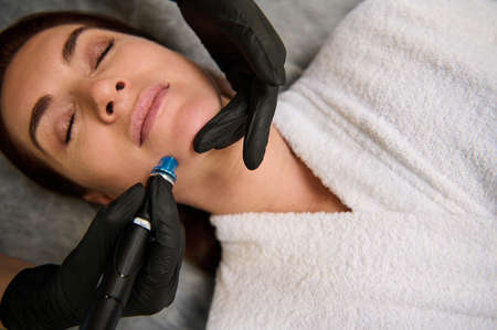 Close-up of a middle aged Caucasian woman getting facial hydro microdermabrasion peeling treatment at cosmetic beauty spa clinic. Hydra vacuum cleaner. Rejuvenation, hydratation, cosmetology conceptの写真素材