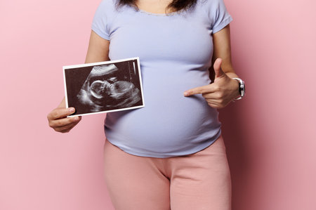 Midsection of a pregnant woman pointing at her belly, showing her newborn baby sonography, ultrasound scanner image, over isolated pink background. Pregnancy. Maternity. Expecting baby Lifestylesの写真素材