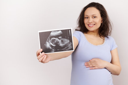 Selective focus on an ultrasound scan image, newborn baby sonography in the hand of a smiling charming pregnant woman, touching her belly, expressing positive emotions, isolated over white backgroundの写真素材