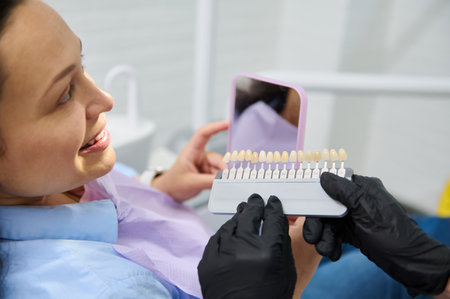 Brunette woman with beautiful smile before receiving dental care check up and teeth whitening bleaching, female doctor wearing exam gloves checks tooth color with a comparison veneer scale chart.の写真素材