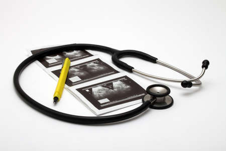 Ultrasound result and stethoscope.の写真素材
