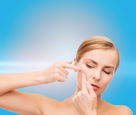 health and beauty concept - face of beautiful young woman squeezing acne spotsの写真素材