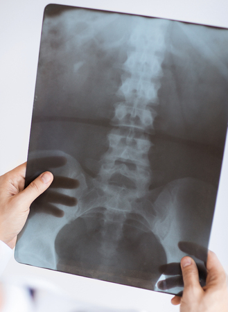 close up of male doctor holding x-ray or roentgen imageの写真素材