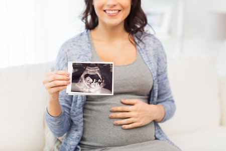 pregnancy, motherhood, people and medicine concept - close up of happy pregnant woman holding at ultrasound image at homeの写真素材