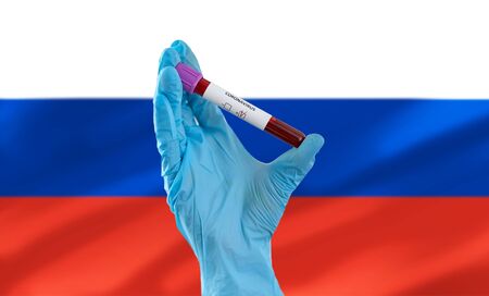 hand holding beaker with coronavirus blood testの写真素材