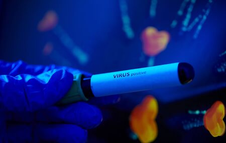 hand holding beaker with coronavirus blood testの写真素材