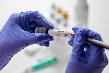 hand holding beaker with coronavirus blood test