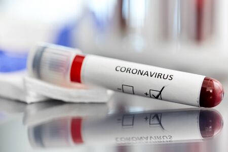 medicine, healthcare and pandemic concept - close up of beaker with positive coronavirus blood test on table at laboratoryの写真素材