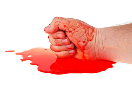 Bloody hand on a white background, close up