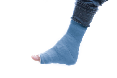 Blue fiberglass and plaster leg cast worn by a young man (isolated on white)の写真素材
