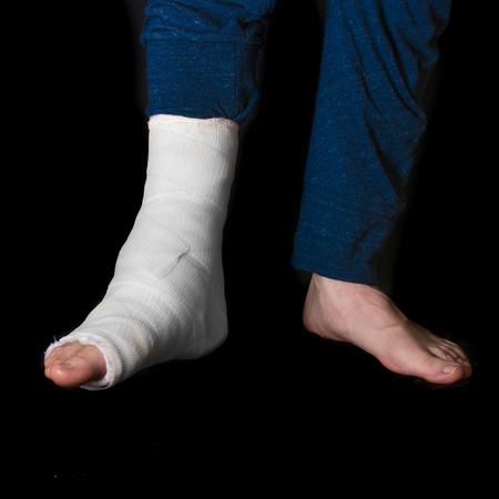 Young man with a broken ankle and a white cast on his leg (barefoot) (isolated on black)の写真素材