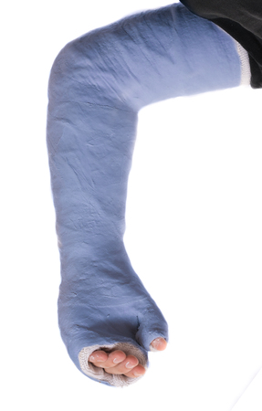 Close up of a young man's blue long arm plaster / fiberglass cast covering the wrist, arm, and elbow after an accident, isolated on whiteの写真素材