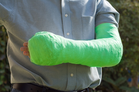 An arm and elbow in a green plaster / fiberglass cast worn by a young man standing in a gardenの写真素材