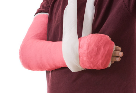 Arm cast - bright red long arm cast in a sling for a broken elbow, arm, or wrist.  Arm covered in  plaster / gypsum / fiberglass.  Isolated on white.の写真素材