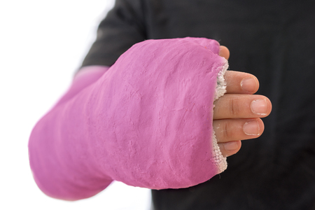 Close up of a pink long arm cast covering the thumb and a part of the fingersの写真素材
