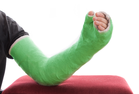A green long arm plaster / fiberglass cast covering the wrist, arm, and elbow, resting on an ottoman, isolated on whiteの写真素材